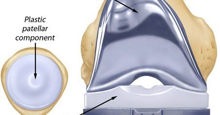 Labor doctor: Patient at work
