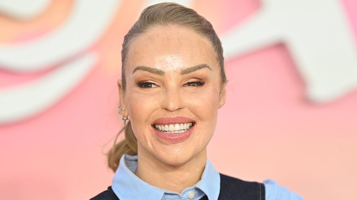 Katie Piper about finding the purpose after "darkness" - and how to build confidence